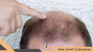 Hair Transplant Scars Prevention and Treatment Options