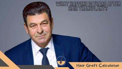 What Happens 10 Years After Hair Transplant